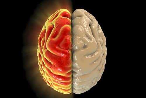 Мигрень боль в одной половине головы