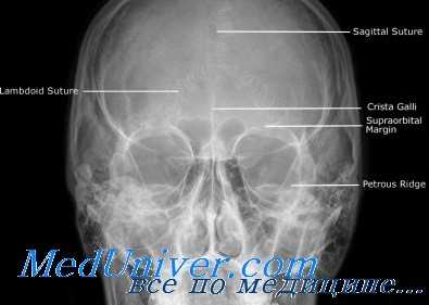 глаз на рентгенограмме при воспалении