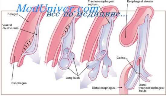 развитие глотки
