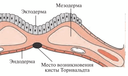 Рассеченный амнион на уровне ротовой мембраны