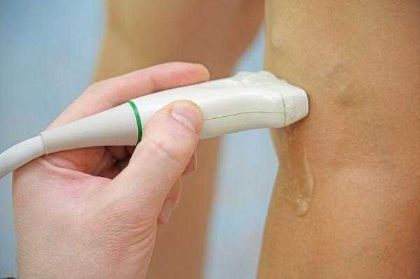 Диагностика варикозного расширения вен нижних конечностей