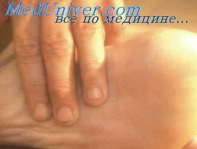 болезненность брюшины