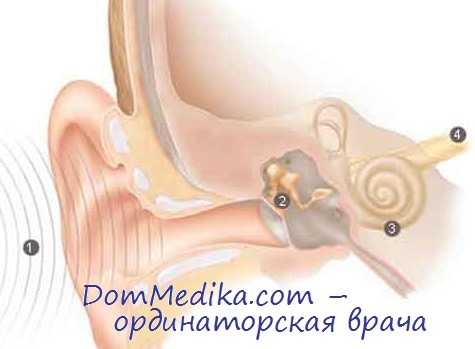 синдром рефсума