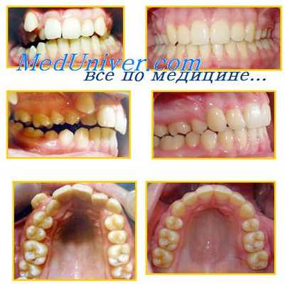 парадонтограмма