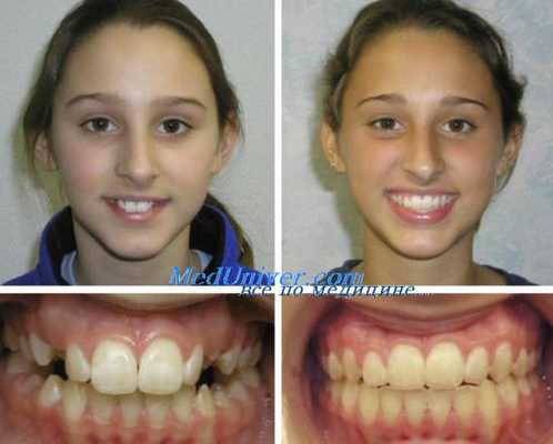 жевательная проба