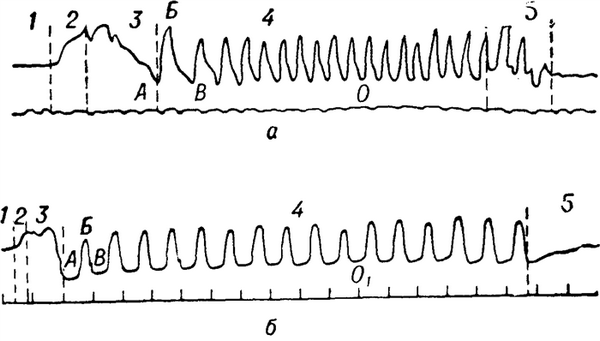 Рис. 4. Мастикациограмма (а) и осциллограмма (б) жевательных движений нижней челюсти: 1 — фаза покоя нижней челюсти; 2 — фаза введения пищи в рот; 3 — фаза начала жевания (ориентировочная); 4 — основная фаза жевания; 5 — фаза формирования пищевого комка и глотания; АБВ — жевательная волна; АБ — восходящая часть волны; Б — вершина; БВ — нисходящая часть волны; О — петля смыкания во время раздавливания пищи; О1 — петля смыкания, соответствующая более длительному смыканию челюстей при раздавливании пищи.