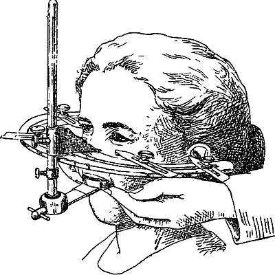 Гнатостат Симона