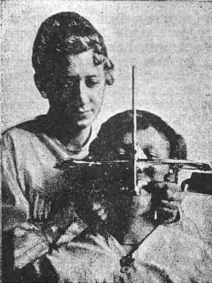 Правильное положение рук врача, головы больного и гнатостата Симона во время снятия оттиска верхней челюсти