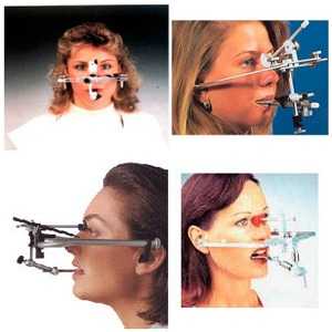 Современные лицевые дуги