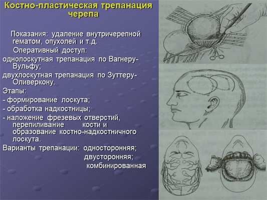 Костно-пластическая трепанация черепа Показания: удаление внутричерепной. 