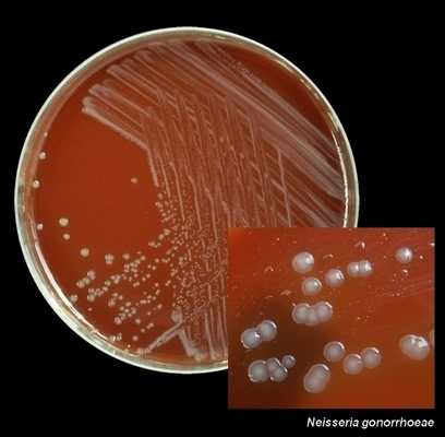 Колония гонококков на агаре