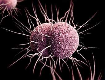 Neisseria gonorrhoeae