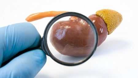 Феохромоцитома