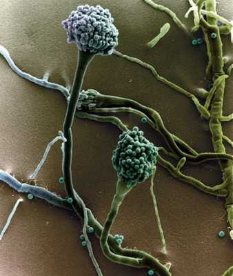 Грибковая пневмония