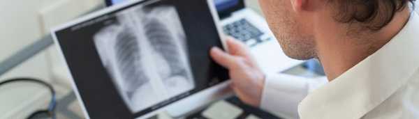 Клиническое наблюдение подострого течения гранулематоза Вегенера под маской серонегативного спондилоартрита