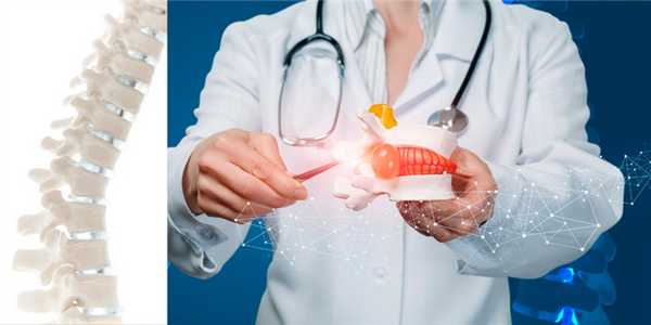 Грыжа шморя