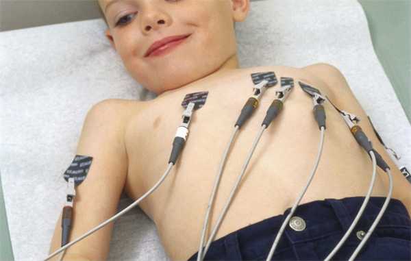 ЭКГ ребенку