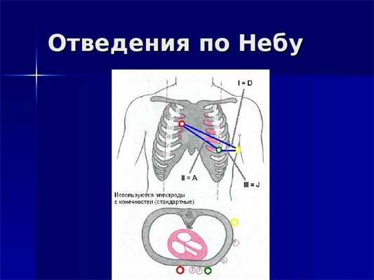 Отведения по Небу