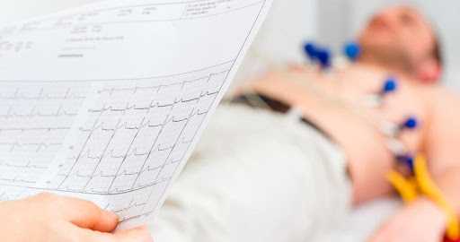 правильное наложение электродов