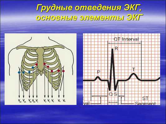 Электрокардиограмма по Слопаку