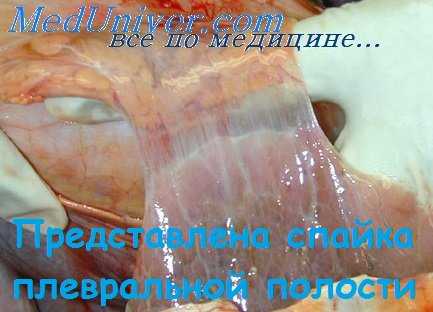 плевральные сращения