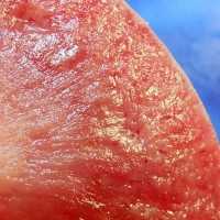 Губчатая почка