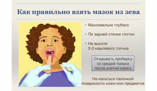 Мазок из зева