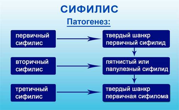 Сифилис в гортани