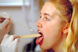 Мазок из зева