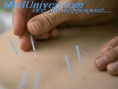 акупунктура при алкоголизме