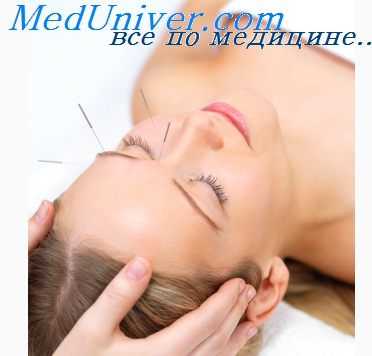 акупунктура полиневропатии