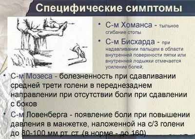 Симптом Мозеса и Хоманса