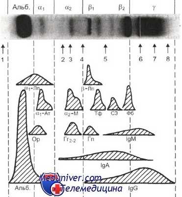 электрофорез плазмы в норме