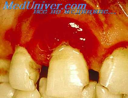 иммунитет в стоматологии