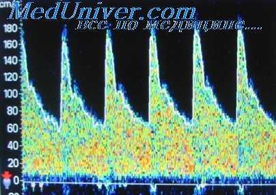 энцефалография