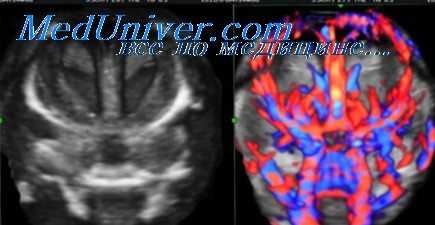 мозговой кровоток