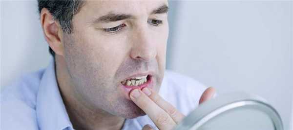 Причины пародонтоза