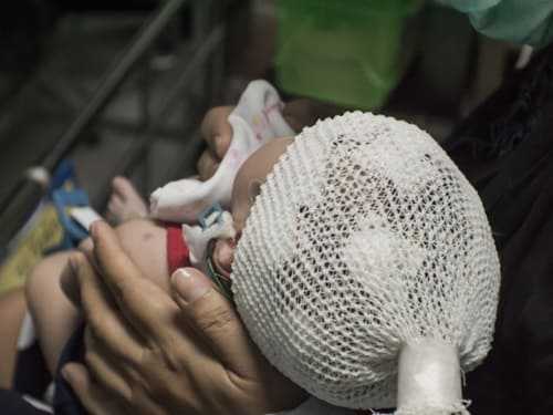 ЭЭГ маленькому ребенку