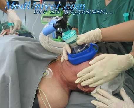 общая анестезия