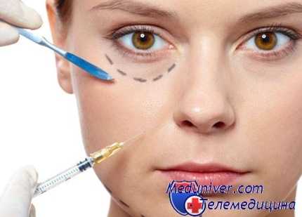 инъекции ботокса