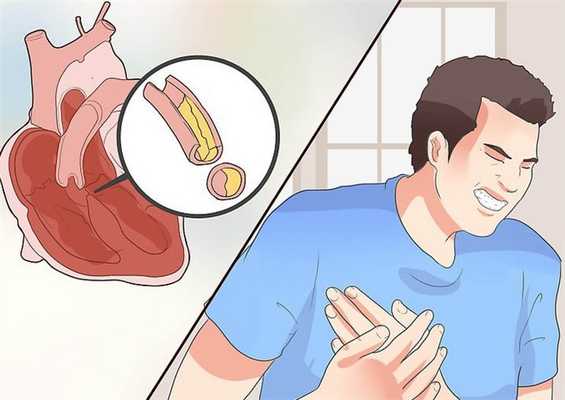 Боли за грудиной - основной симптом ИБС