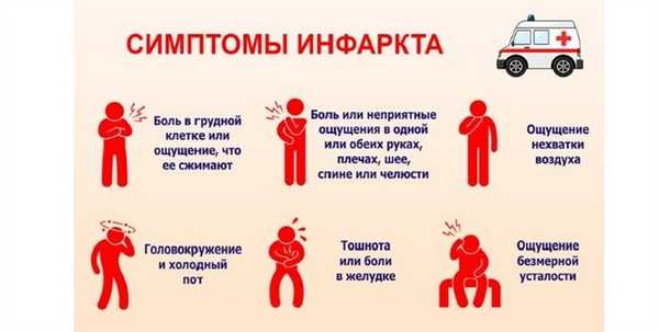 Симптомы инфаркта