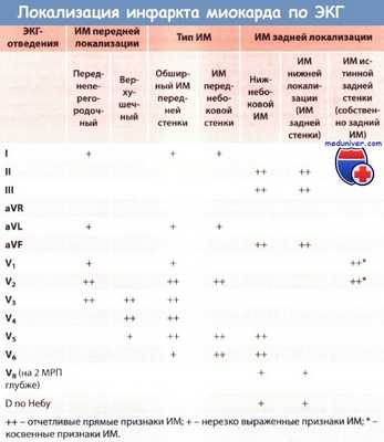 Определение локализации инфаркта миокарда по ЭКГ