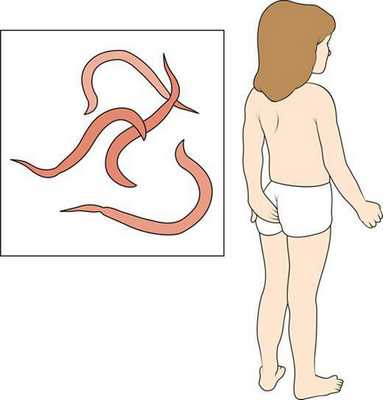 Зуд в области ануса