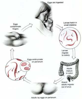 Механизм заражения энтеробиозом