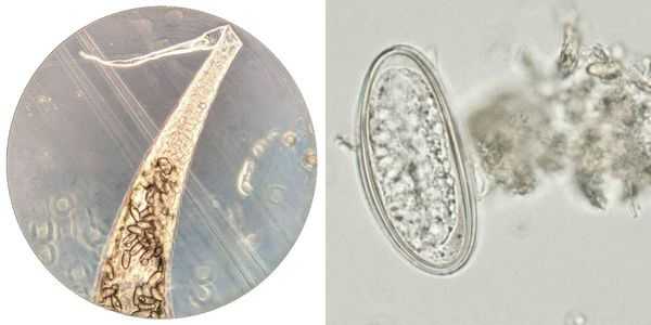 Яйца остриц