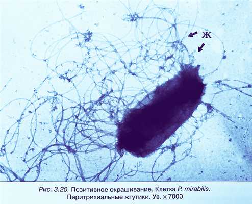 Энтеробактерии p.mirabilis