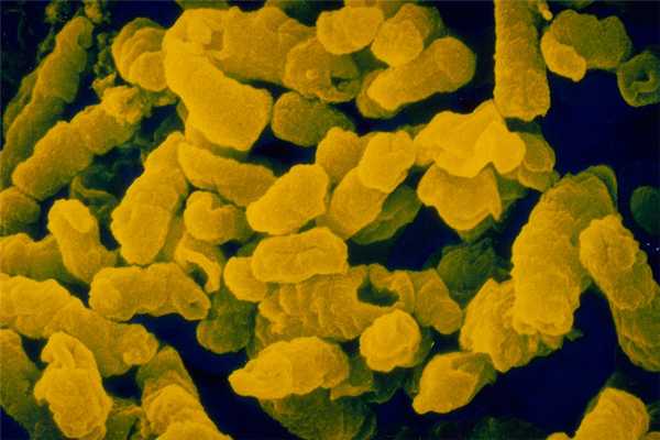 Тромботическая тромбоцитопеническая пурпура (ТТП)