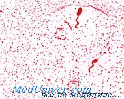 возбудитель холеры - Vibrio cholerae