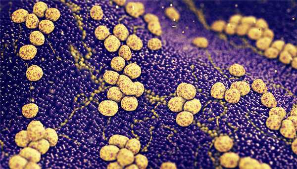 Золотистый стафилококк